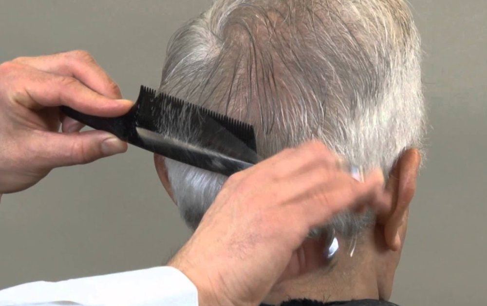 All you need to know about the home haircut for patients Dubai